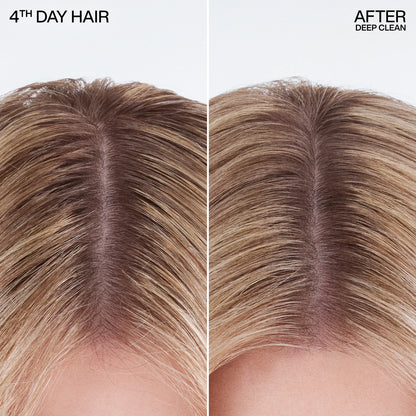Deep Clean Dry Shampoo - US 0687